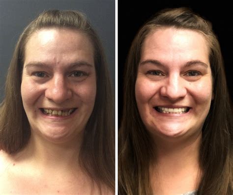 The Magic of Dental Beauty: Unveiling Fental Weslack's Techniques in Weslack, TX